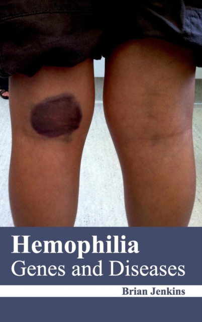 Hemophilia: Genes and Diseases, Hardback Book