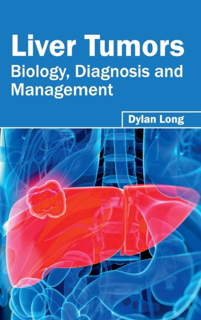 Liver Tumors: Biology, Diagnosis and Management, Hardback Book