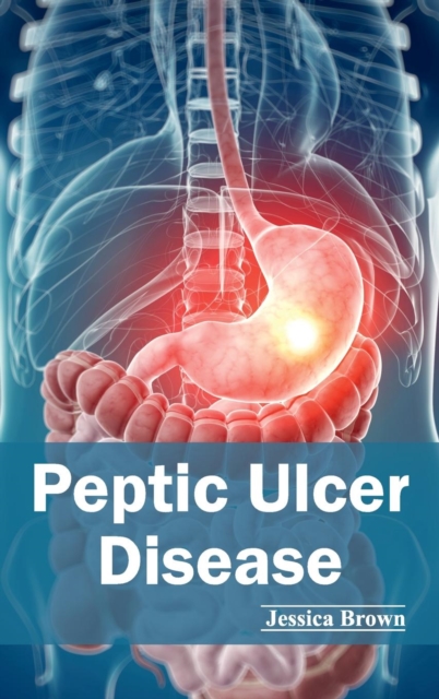 Peptic Ulcer Disease, Hardback Book