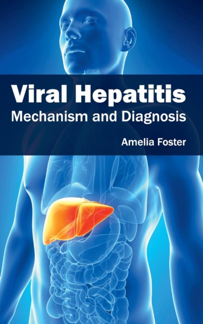 Viral Hepatitis: Mechanism and Diagnosis, Hardback Book