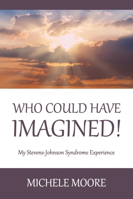 Who Could Have Imagined! : My Stevens-Johnson Syndrome Experience, Paperback / softback Book