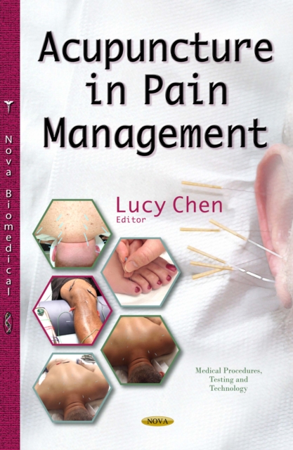 Acupuncture in Pain Management, PDF eBook