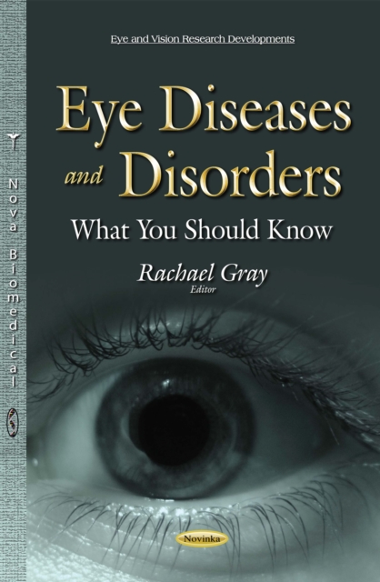 Eye Diseases and Disorders : What You Should Know, PDF eBook