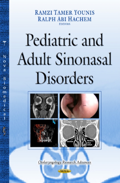 Paranasal Sinuses : Anatomy, Development & Biological Function, Hardback Book