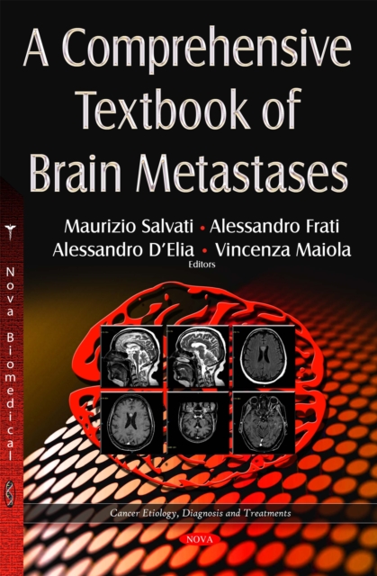 A Comprehensive Textbook of Brain Metastases, PDF eBook