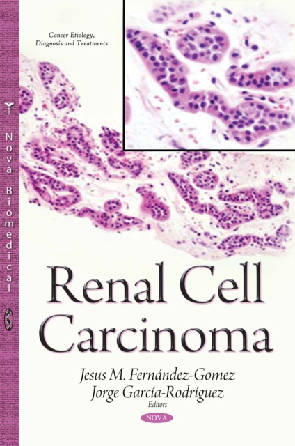 Renal Cell Carcinoma, PDF eBook