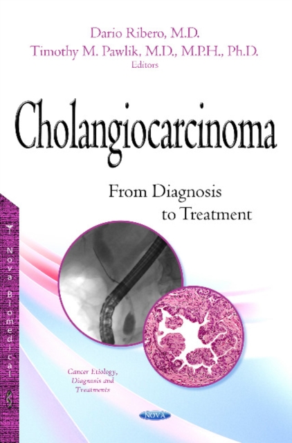 Cholangiocarcinoma : From Diagnosis to Treatment, Hardback Book
