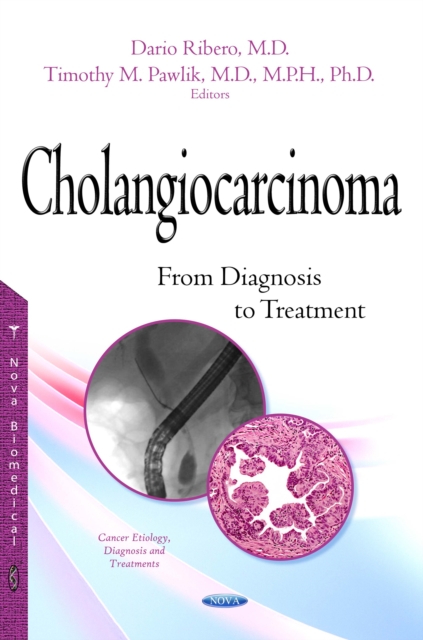 Cholangiocarcinoma : From Diagnosis to Treatment, PDF eBook