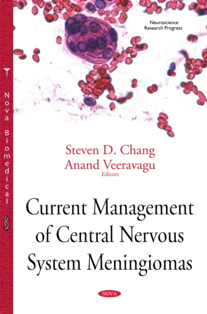 Current Management of Central Nervous System Meningiomas, PDF eBook