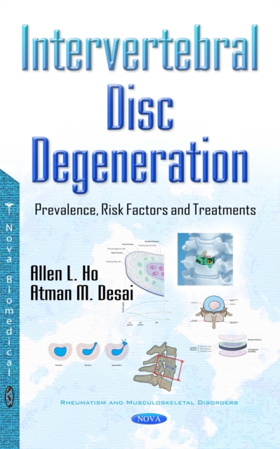 Intervertebral Disc Degeneration : Prevalence, Risk Factors and Treatments, PDF eBook