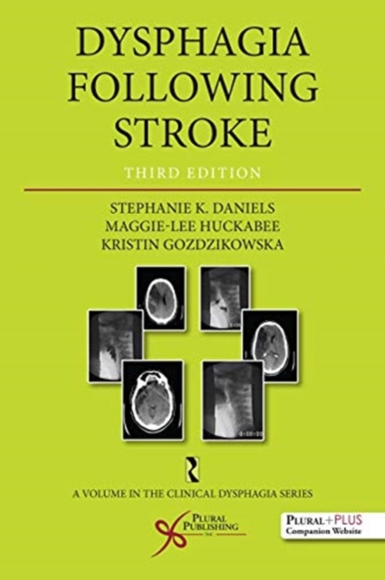 Dysphagia Following Stroke, Paperback / softback Book