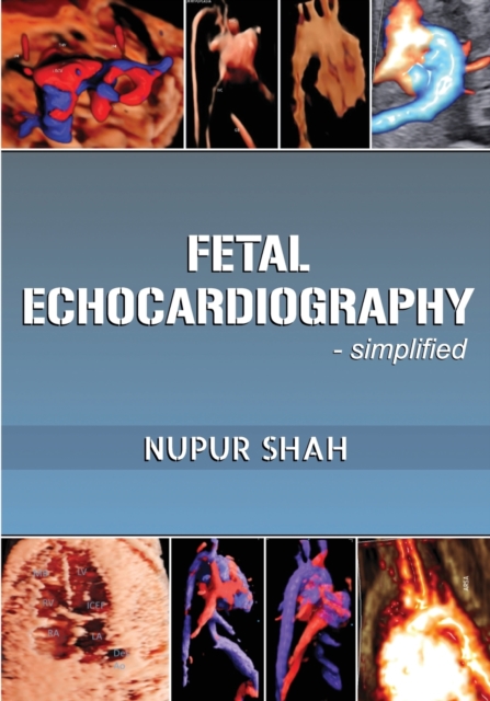 Fetal Echocardiography, Book Book