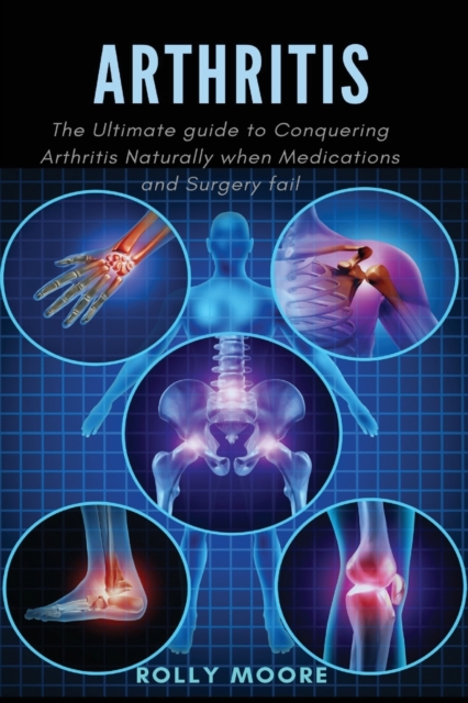 Arthritis : The ultimate guide to Conquering Arthritis Naturally when Medications and Surgery fail, Paperback / softback Book