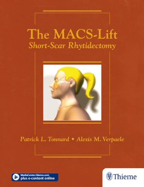 The MACS-Lift : Short-Scar Rhytidectomy, EPUB eBook
