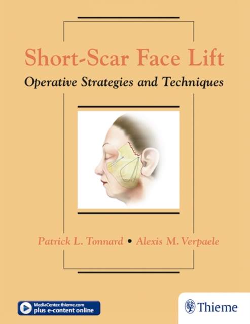Short-Scar Face Lift : Operative Strategies and Techniques, EPUB eBook