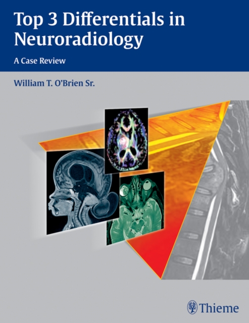 Top 3 Differentials in Neuroradiology : A Case Review, EPUB eBook