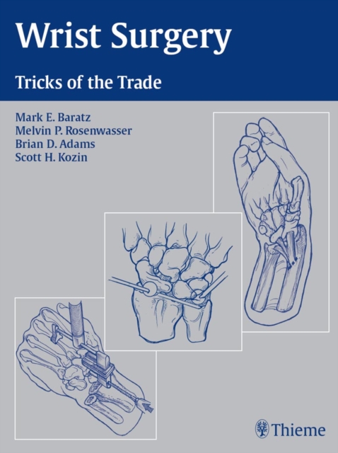 Wrist Surgery : Tricks of the Trade, EPUB eBook