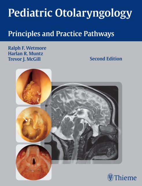 Pediatric Otolaryngology : Principles and Practice Pathways, EPUB eBook