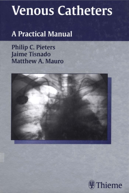 Venous Catheters : A Practical Manual, EPUB eBook