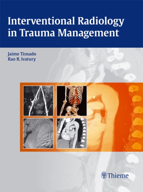 Interventional Radiology in Trauma Management, EPUB eBook