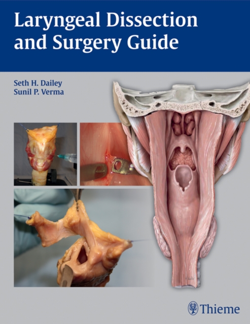 Laryngeal Dissection and Surgery Guide, EPUB eBook