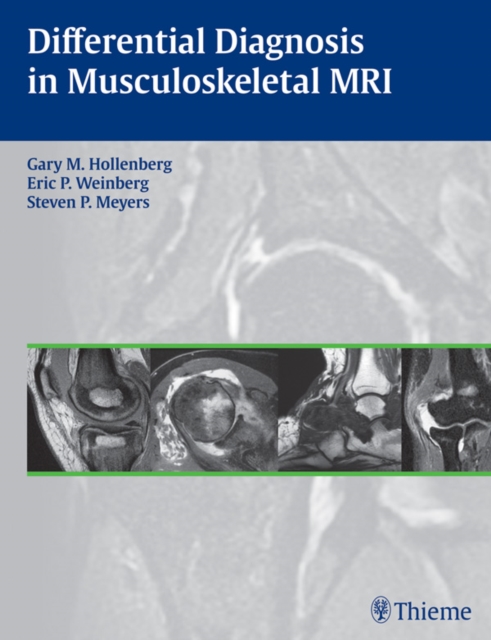 Differential Diagnosis in Musculoskeletal MRI, EPUB eBook