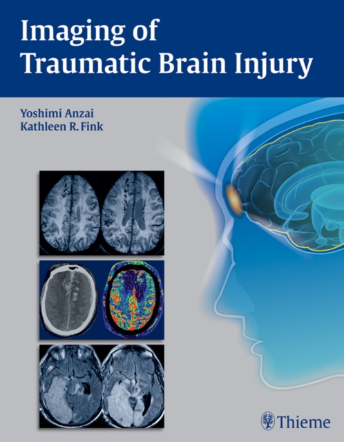 Imaging of Traumatic Brain Injury, EPUB eBook