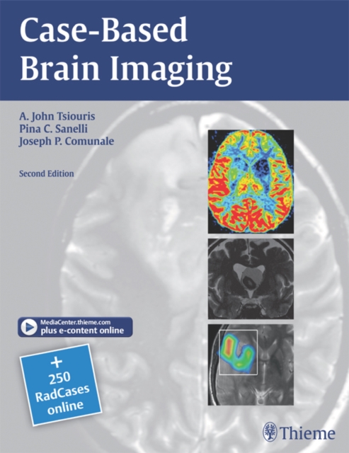 Case-Based Brain Imaging, EPUB eBook