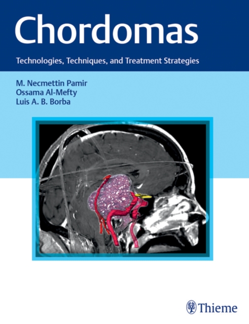 Chordomas : Technologies, Techniques, and Treatment Strategies, EPUB eBook