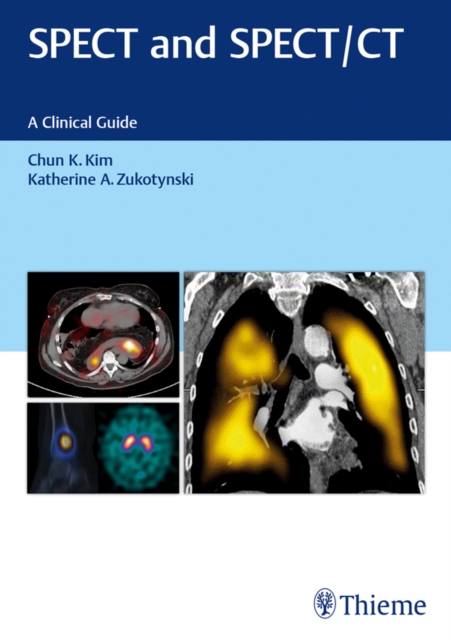 SPECT and SPECT/CT : A Clinical Guide, EPUB eBook