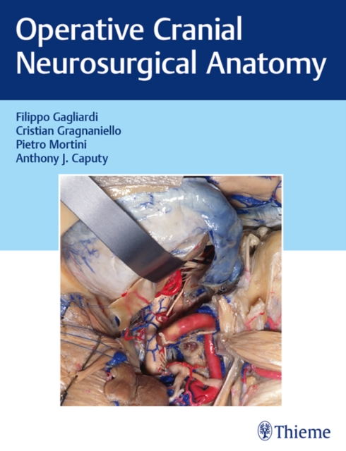 Operative Cranial Neurosurgical Anatomy, EPUB eBook