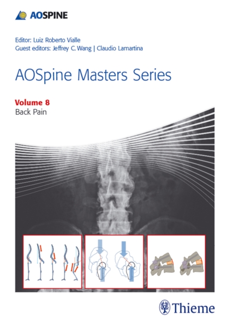 AOSpine Masters Series, Volume 8: Back Pain, EPUB eBook