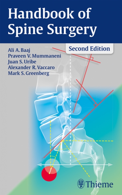 Handbook of Spine Surgery, EPUB eBook