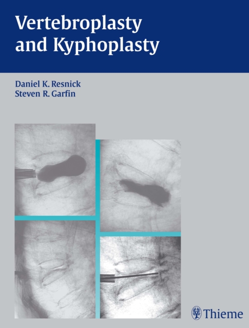 Vertebroplasty and Kyphoplasty, EPUB eBook