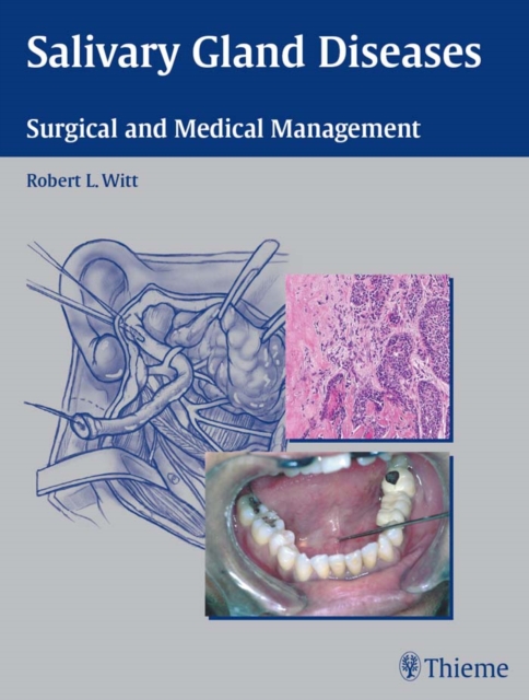 Salivary Gland Diseases : Surgical and Medical Management, EPUB eBook