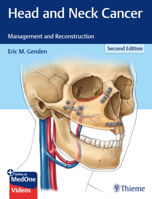 Head and Neck Cancer : Management and Reconstruction, EPUB eBook