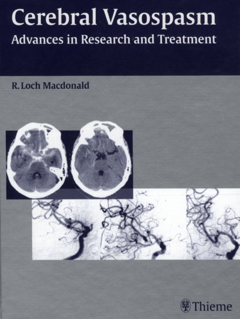 Cerebral Vasospasm : Advances in Research and Treatment, EPUB eBook