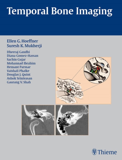 Temporal Bone Imaging, EPUB eBook