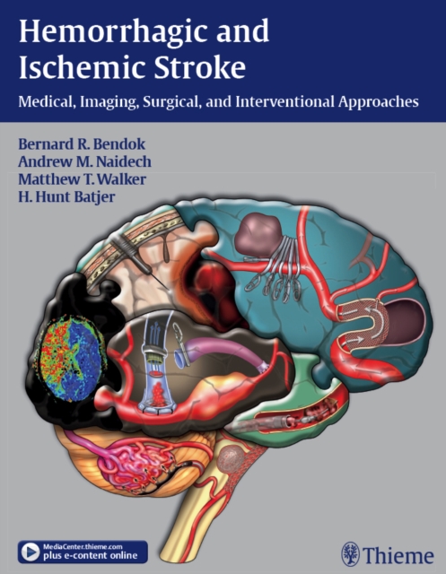 Hemorrhagic and Ischemic Stroke : Medical, Imaging, Surgical and Interventional Approaches, EPUB eBook