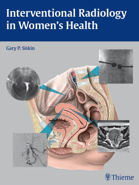 Interventional Radiology in Women's Health, EPUB eBook