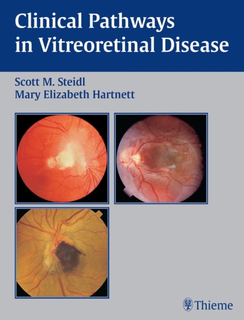 Clinical Pathways In Vitreoretinal Disease, EPUB eBook