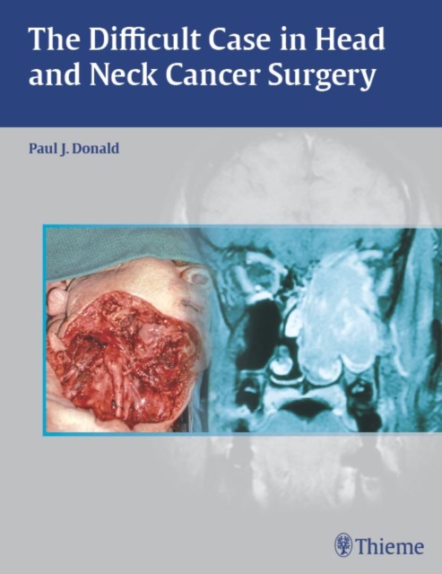 The Difficult Case in Head and Neck Cancer Surgery, EPUB eBook