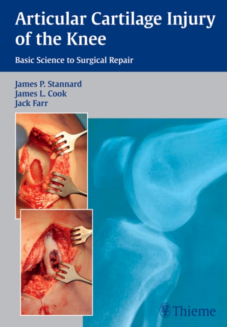 Articular Cartilage Injury of the Knee: Basic Science to Surgical Repair, EPUB eBook