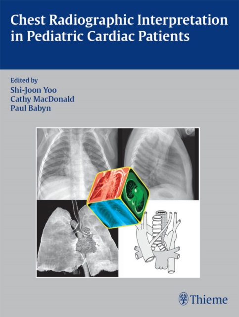 Chest Radiographic Interpretation in Pediatric Cardiac Patients, EPUB eBook