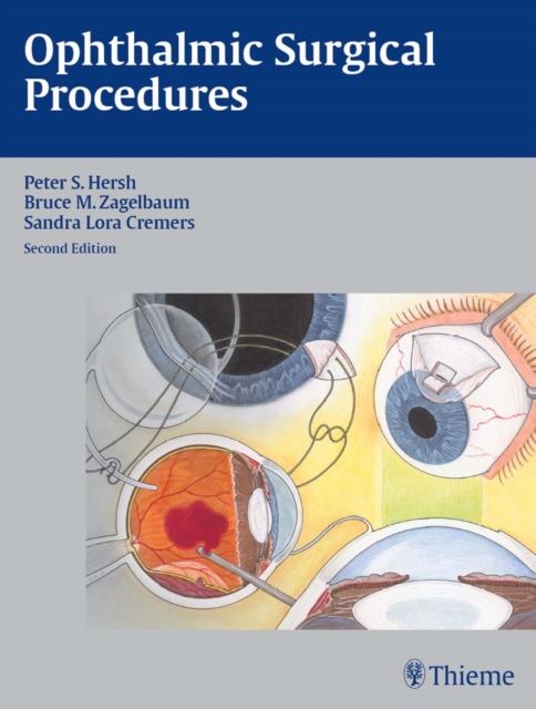 Ophthalmic Surgical Procedures, EPUB eBook