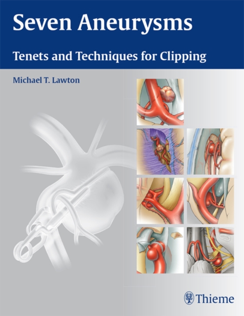 Seven Aneurysms : Tenets and Techniques for Clipping, EPUB eBook