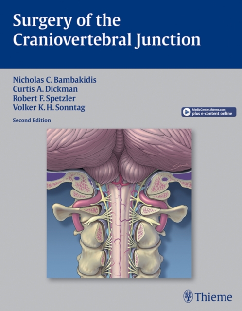 Surgery of the Craniovertebral Junction, EPUB eBook