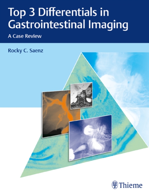 Top 3 Differentials in Gastrointestinal Imaging : A Case Review, EPUB eBook