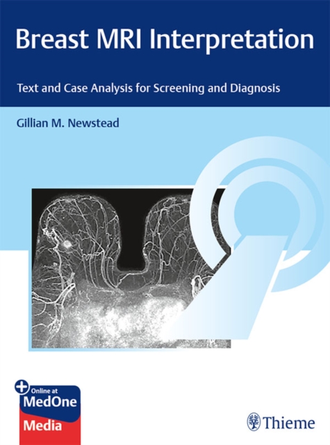 Breast MRI Interpretation : Text and Case Analysis for Screening and Diagnosis, EPUB eBook