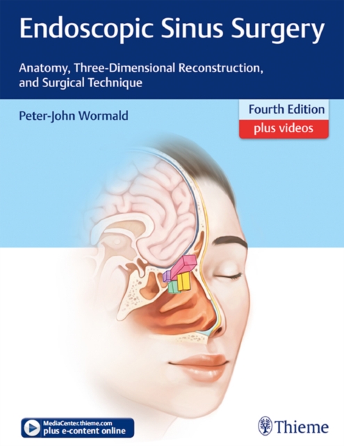 Endoscopic Sinus Surgery : Anatomy, Three-Dimensional Reconstruction, and Surgical Technique, EPUB eBook